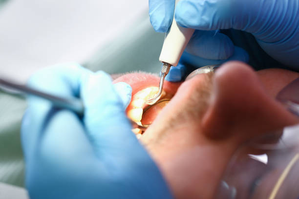 Best Mobile Emergency Dentist in Mount Olive, IL