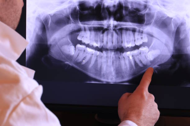 Best Emergency Dental Care for Abscessed Tooth in Mount Olive, IL