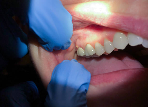 Best Weekend Emergency Dentist in Mount Olive, IL